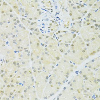 Immunohistochemistry - BRCA1 Polyclonal Antibody (144-11549)
