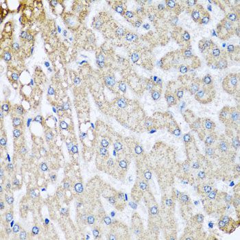 Immunohistochemistry - COX5B Polyclonal Antibody (144-02640)