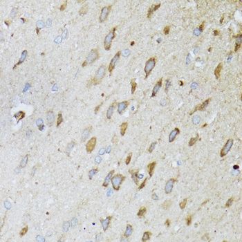Immunohistochemistry - ND5 antibody (144-08135)