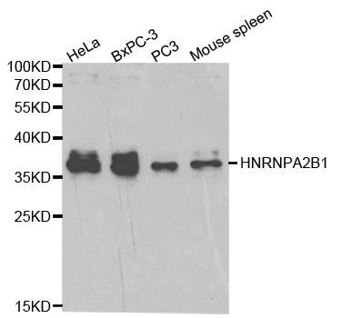 Western blot - [KO Validated] HNRNPA2B1 Polyclonal Antibody (144-01162)