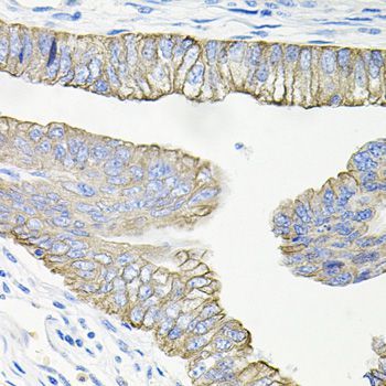 Immunohistochemistry - ACVR2A Polyclonal Antibody (144-01981)