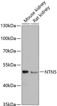 Western blot