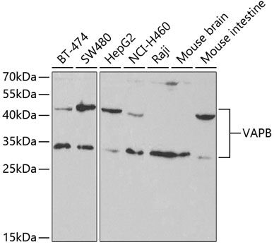 Western blot