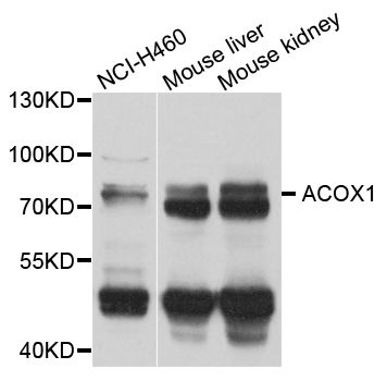 Western blot - ACOX1 antibody (144-08091)