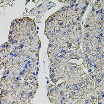 Immunohistochemistry - CA9 Polyclonal Antibody (144-60443)