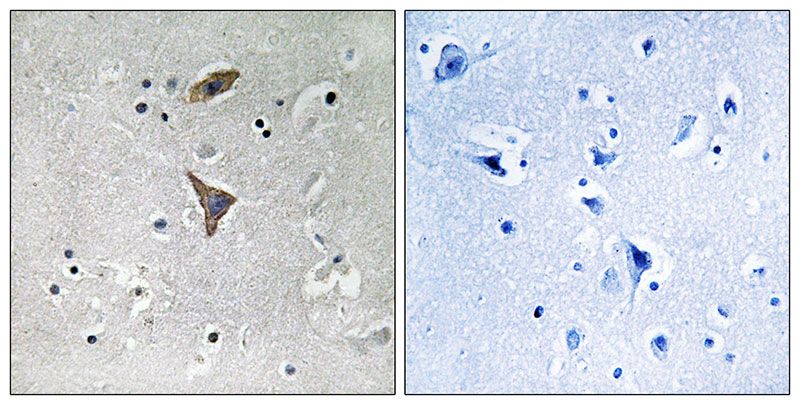 IHC