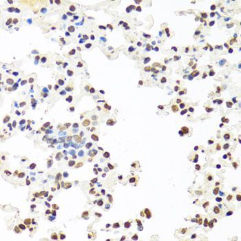 Immunohistochemistry - SFPQ Polyclonal Antibody (144-00958)