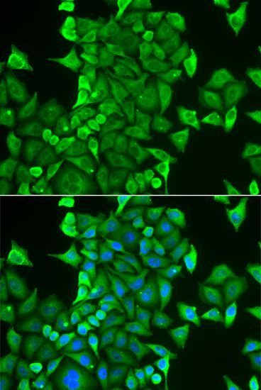 Immunofluorescence - CARS antibody (144-06540)