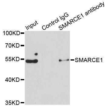 Immunofluorescence - [KO Validated] SMARCE1 Polyclonal Antibody (144-602973)