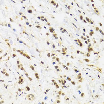 Immunohistochemistry - RAD50 Polyclonal Antibody (144-60013)
