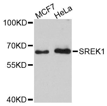 Western blot - SREK1 antibody (144-60247)