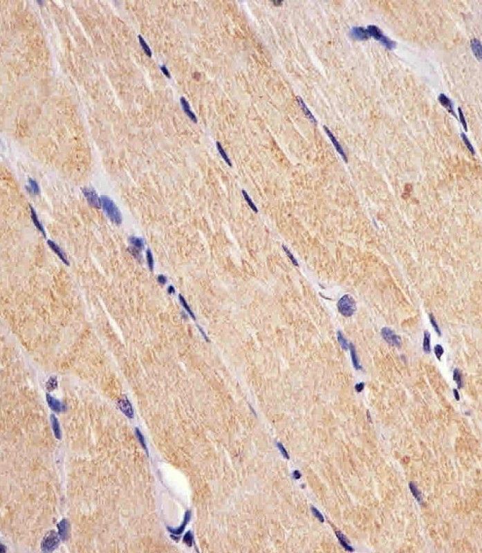 IHC-P