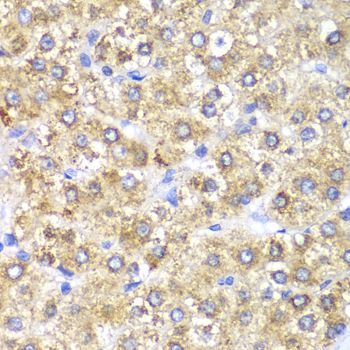 Immunohistochemistry - SHMT2 Polyclonal Antibody (144-01215)
