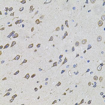 Immunohistochemistry - FOXO3 Polyclonal Antibody (144-00102)