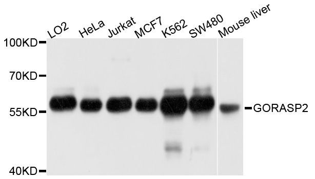 Western blot - GORASP2 Polyclonal Antibody (144-600543)