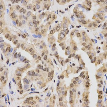 Immunohistochemistry - MonoMethyl-Histone H3-K27 antibody (144-02361)