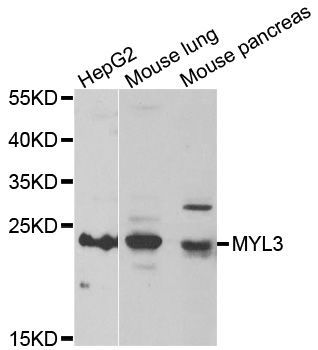 Western blot - MYL3 antibody (144-06662)