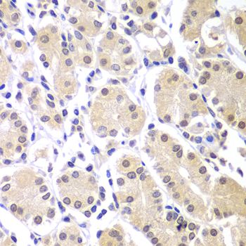 Immunohistochemistry - CHEK1 Polyclonal Antibody (144-07653)