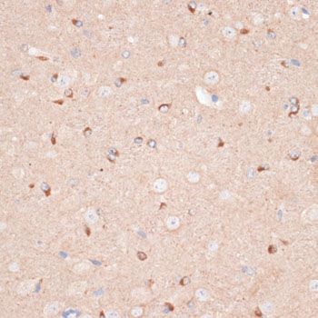 Immunohistochemistry - KIF5A antibody (144-03303)