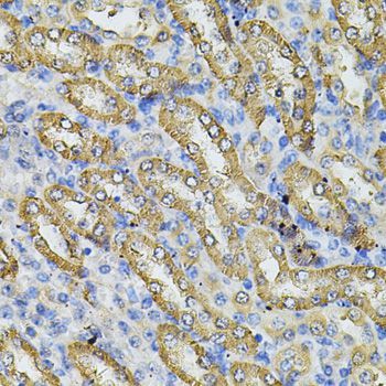 Immunohistochemistry - SPTLC1 Antibody (144-06750)