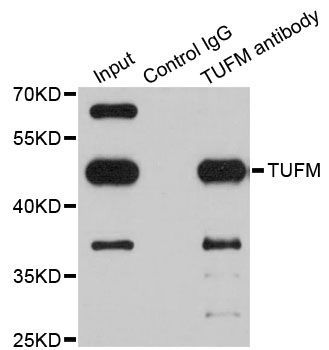 Immunohistochemistry - TUFM Polyclonal Antibody (144-06423)