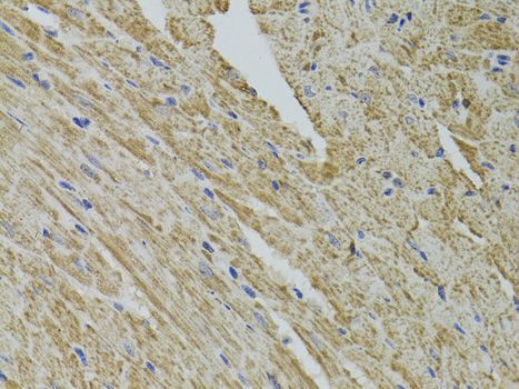 Immunohistochemistry - FHIT antibody (144-01196)