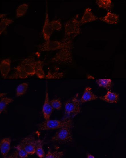 Immunofluorescence - NRF1 Polyclonal Antibody (144-05547)