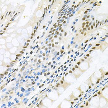 Immunohistochemistry - MAPK8 Polyclonal Antibody (144-00288)