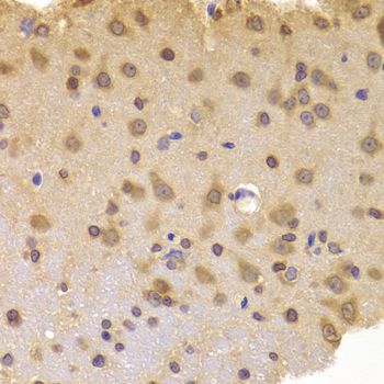 Immunohistochemistry - ROCK2 Polyclonal Antibody (144-05698)