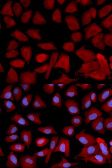 Immunofluorescence - PSMC4 antibody (144-02505)