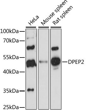 Western blot