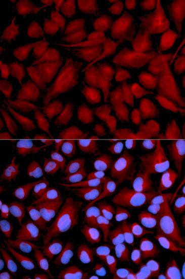 Immunofluorescence - CASK antibody (144-02501)