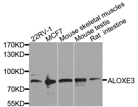 Western blot - ALOXE3 antibody (144-08245)