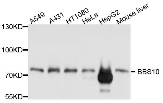 Western blot - BBS10 antibody (144-08820)