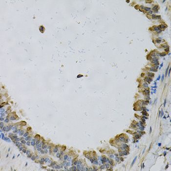 Immunohistochemistry - EFNA1 Polyclonal Antibody (144-05341)