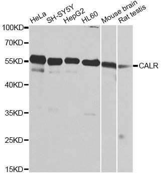 Western blot - CALR Polyclonal Antibody (144-01066)