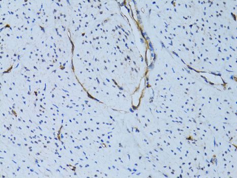 Immunohistochemistry - SELE Antibody (144-02191)