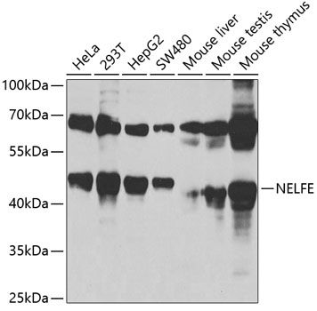 Western blot