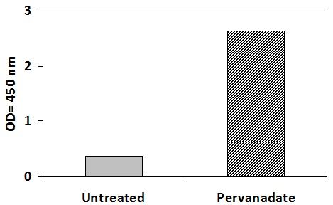 EphB2 Pervanadate Stimulation of Jurkat Cell Line