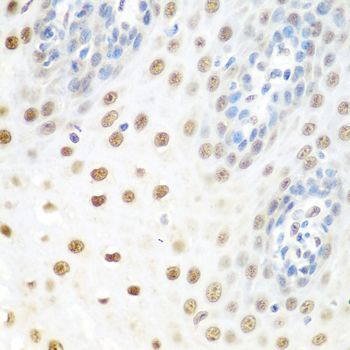 Immunohistochemistry - DDX39B Polyclonal Antibody (144-08356)