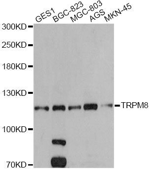 Western blot - TRPM8 antibody (144-05333)