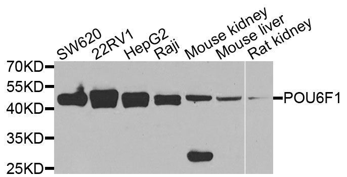 Western blot - POU6F1 Polyclonal Antibody (144-07299)