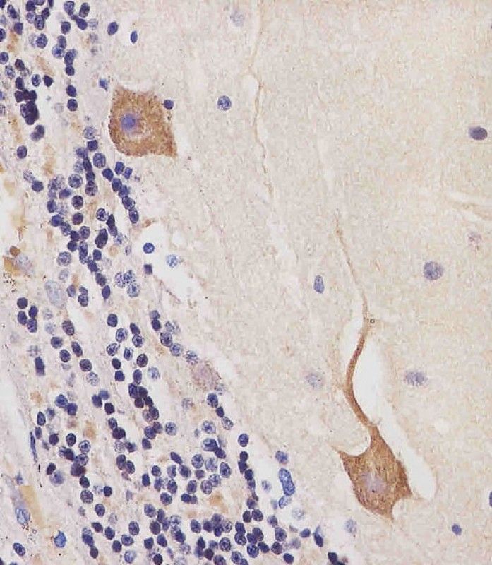 IHC-P