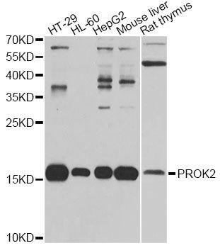 Western blot - PROK2 antibody (144-06705)