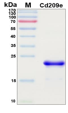 SDS-PAGE Image