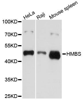 Western blot - HMBS antibody (144-01777)