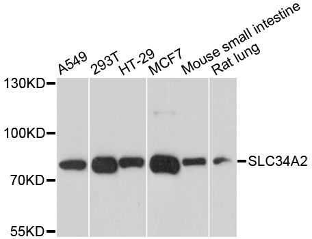 Western blot - SLC34A2 antibody (144-61476)