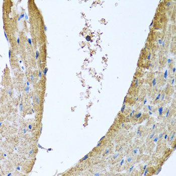 Western blot - COX5B Polyclonal Antibody (144-02640)