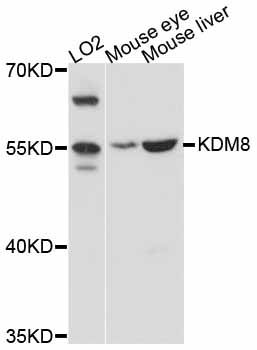Western blot - KDM8 antibody (144-011606)