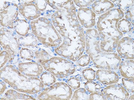 Immunohistochemistry - SNAI1 antibody (144-011794)